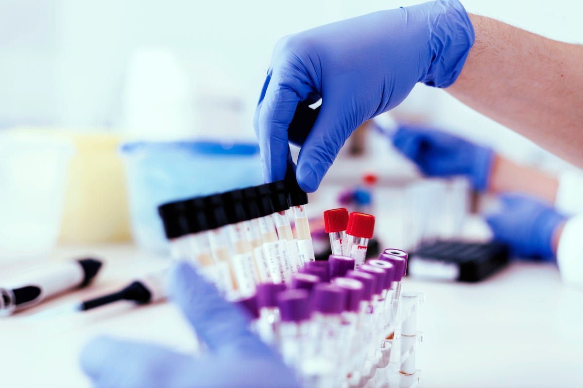 New test could detect one of the most common forms of cancer
